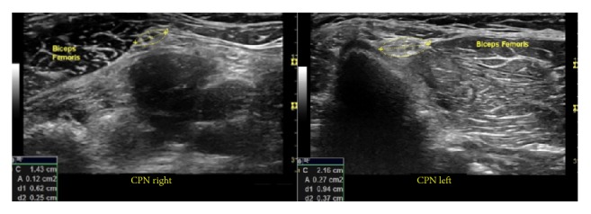 Figure 24