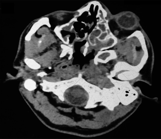 Fig. 2