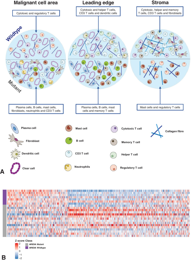 Figure 6. Diagrammatic summary of the differences in the TME of ARID1A-wildtype (ARID1Awt) and -mutant (ARID1Amut) advanced CCOC and relationship to endometriosis. A, Schematic highlighting the immune cell populations significantly different between ARID1Awt and ARID1Amut CCOC across the MCA, LE, and stroma. Top half illustrates the composition of ARID1Awt tumors and in the bottom-half illustrates the composition of ARID1Amut tumors. B, Heat map showing expression of endometriosis-associated genes in ARID1Awt and ARID1Amut CCOC. Two data sets were used (10, 23) to assess significant DEGs between ectopic endometriosis and normal endometrium. A total of 641 DEGs in the AOCS data set are shown in the heat map. Red: upregulation and blue: downregulation in ARID1Awt tumors. N = 7 ARID1Awt (purple) and N = 15 ARID1Amut (gray).