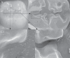FIGURE-1