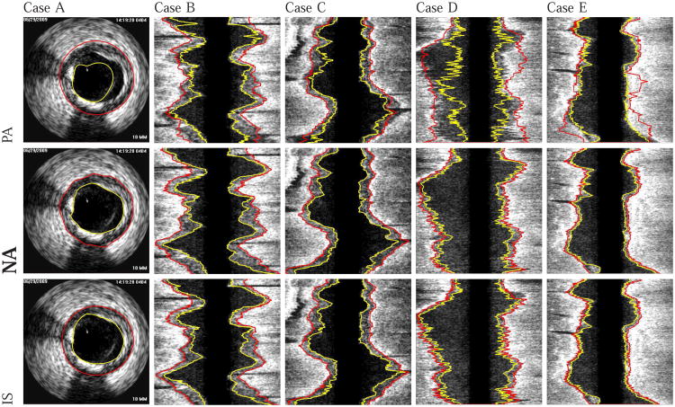 Fig. 10