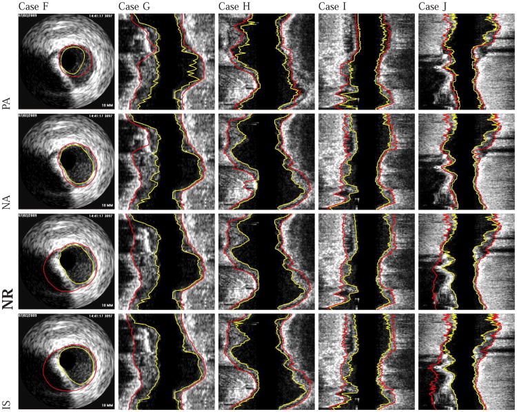 Fig. 12