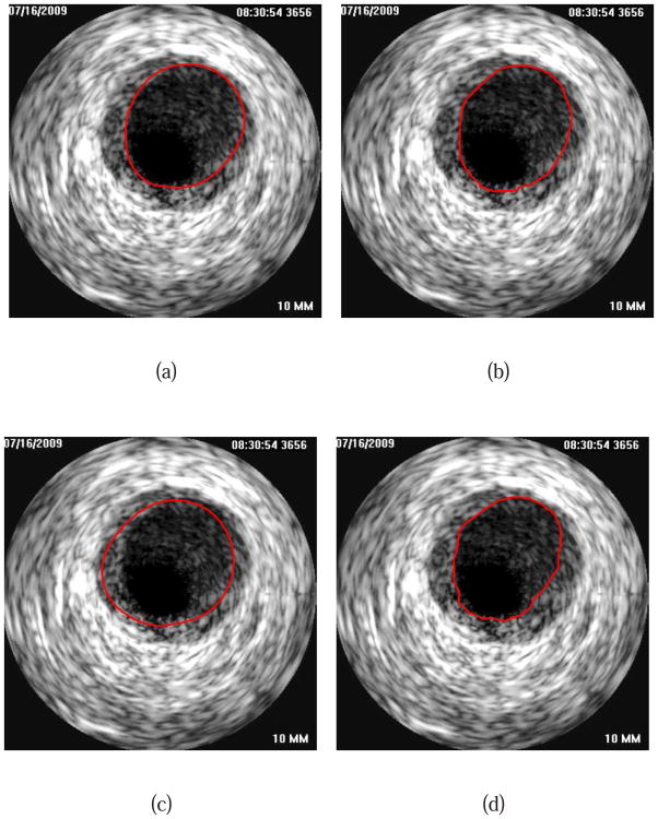 Fig. 17