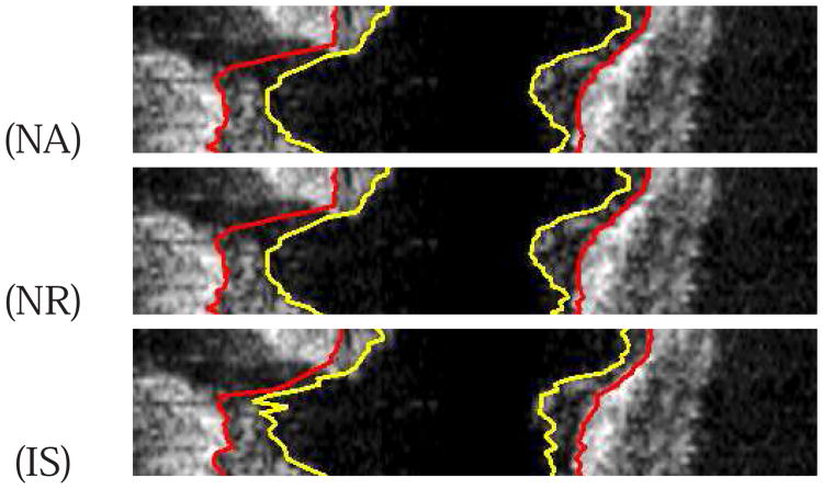 Fig. 14