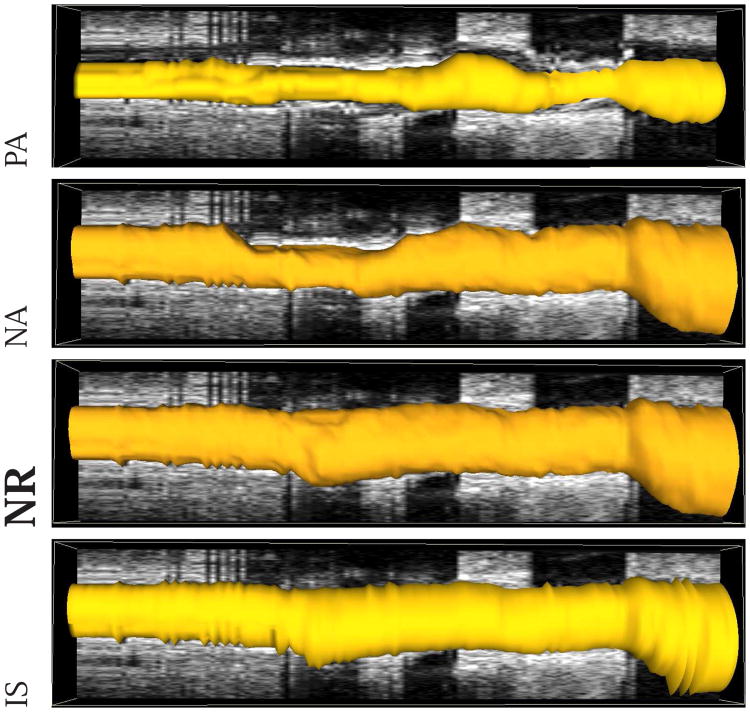 Fig. 11