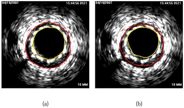 Fig. 15