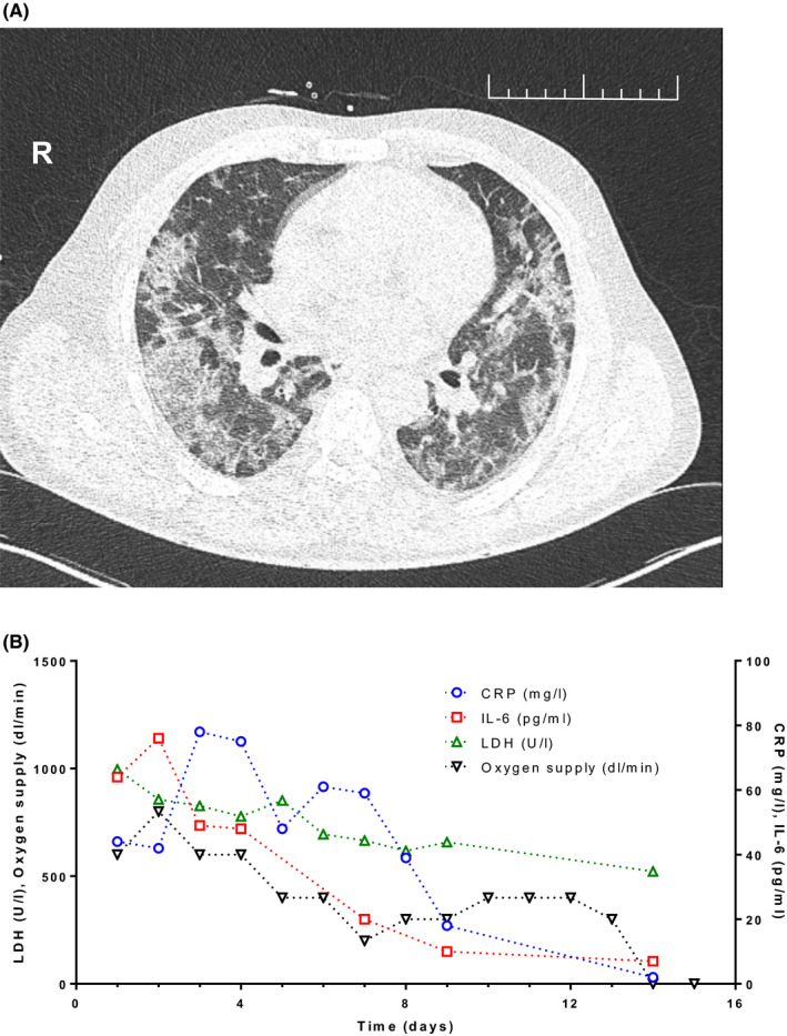 FIGURE 1