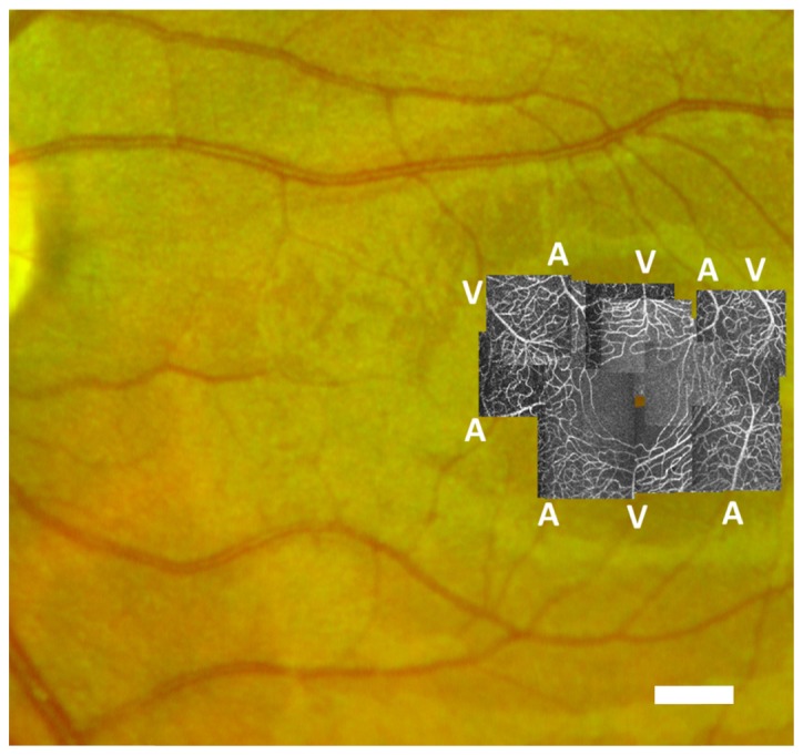 Fig. 2