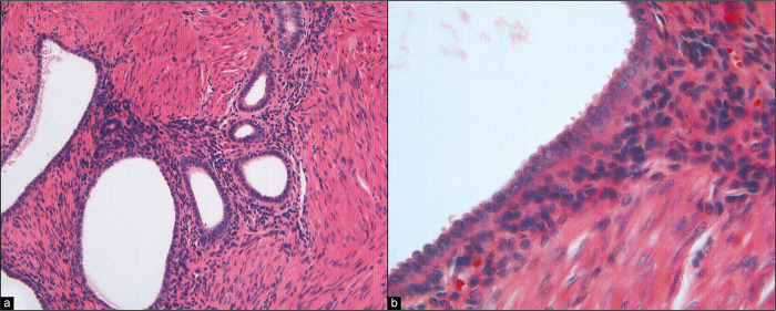 Figure 23: