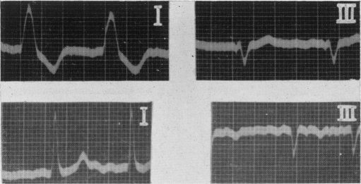 Fig. 11