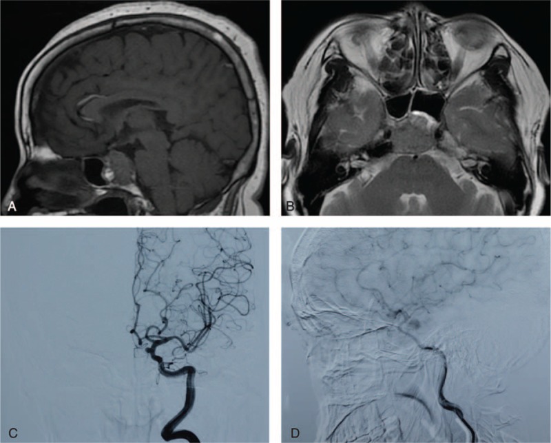 FIGURE 1