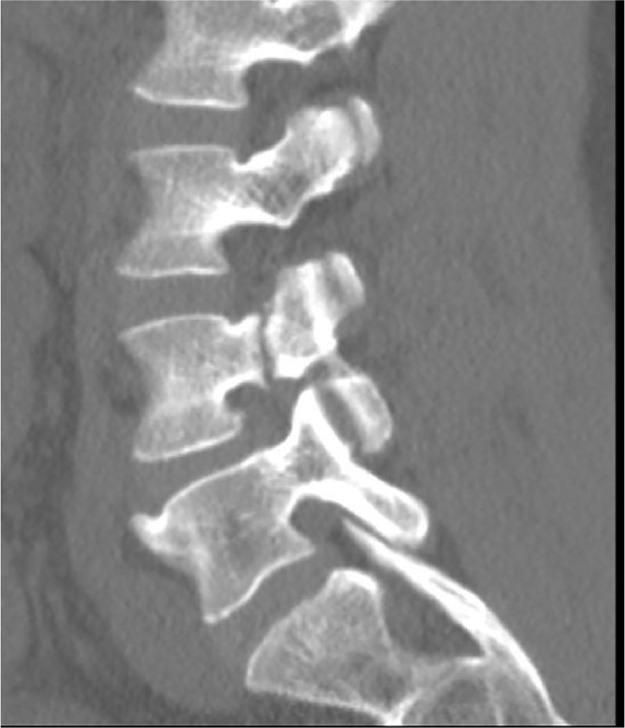 Fig. 2 –