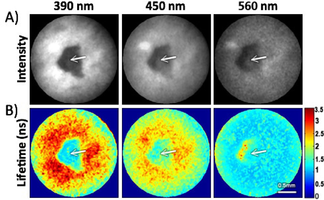 Fig. 3