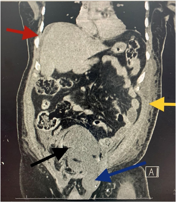 Fig. 3