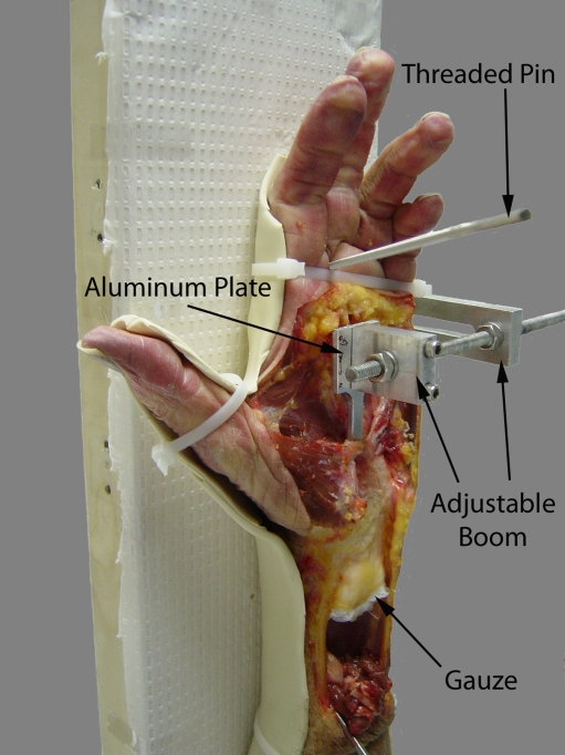 Figure 1