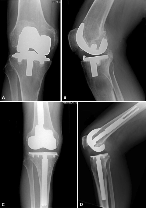 Fig. 3A–D