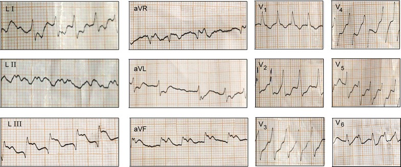 Fig. 1