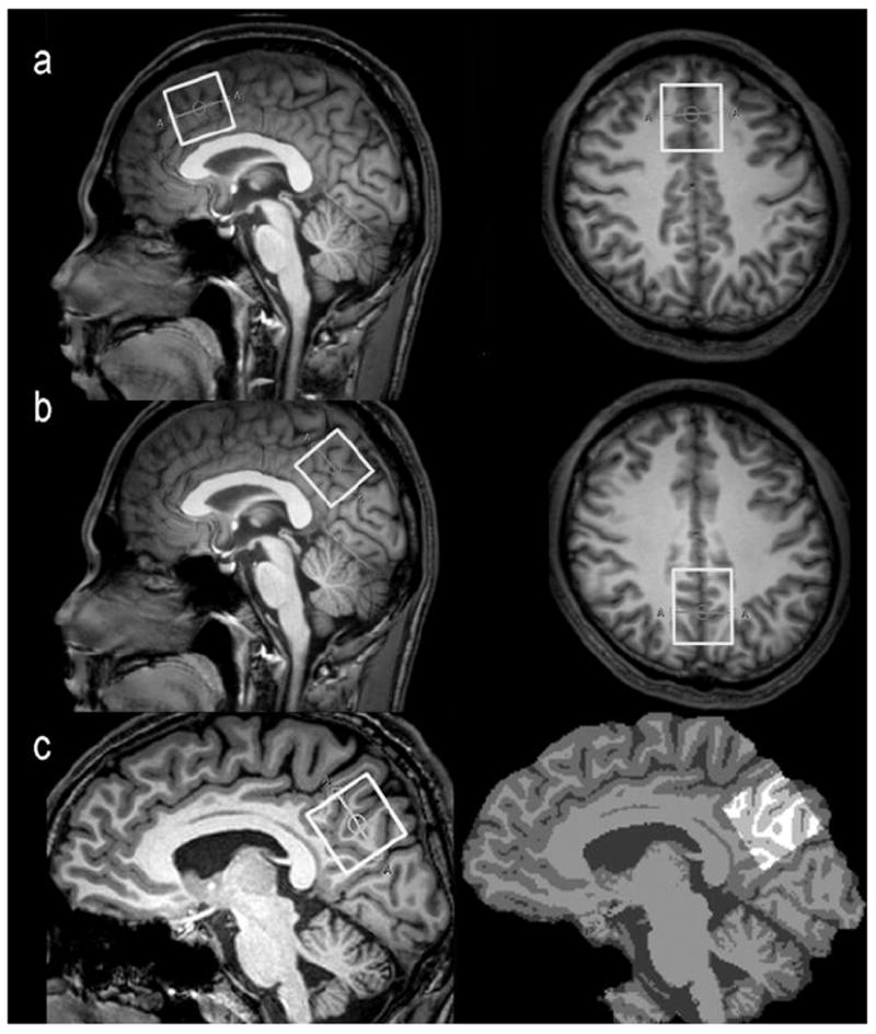 Fig.1