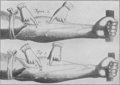 Fig. 10b