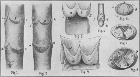 Fig. 16a