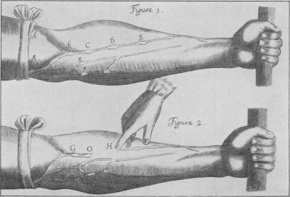 Fig. 10a