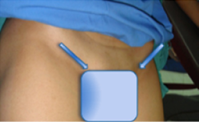 Fig. 1
