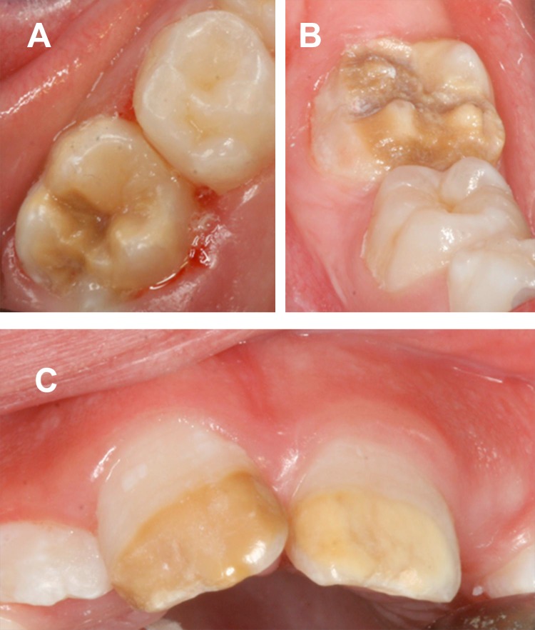 FIGURE 16.