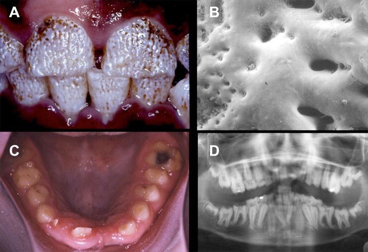 FIGURE 17.