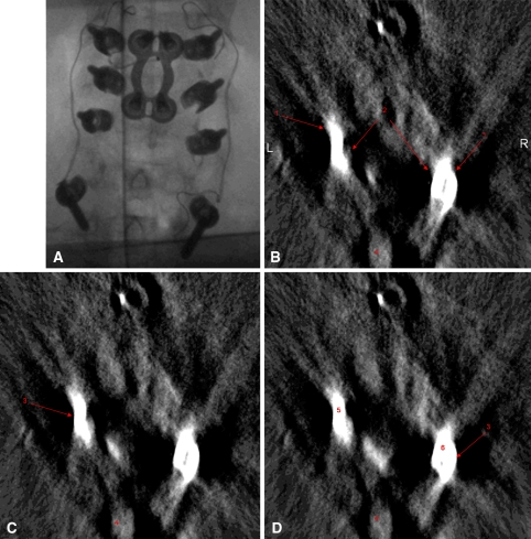 Fig. 2A–D