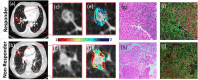 Fig. 1 (abstract P104).