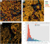 Fig. 1 (abstract P106).