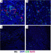 Fig. 1 (abstract P124).