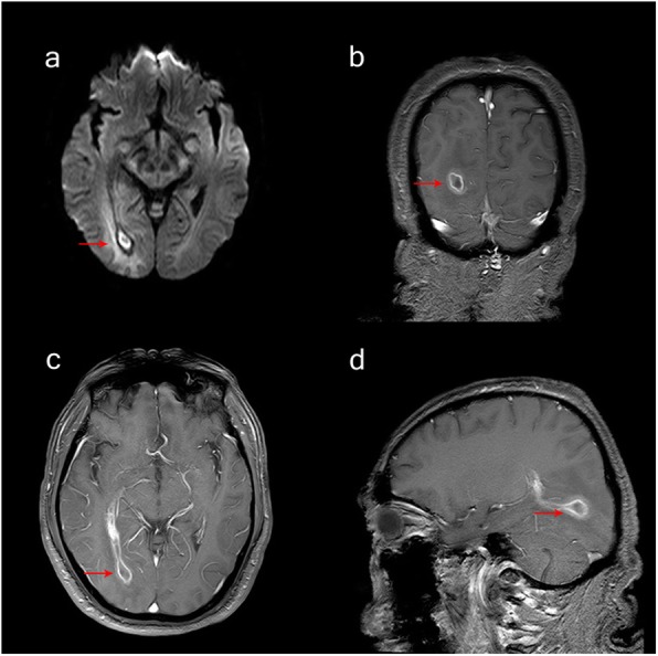 Fig. 6