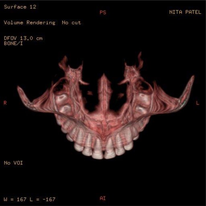 Fig 4.
