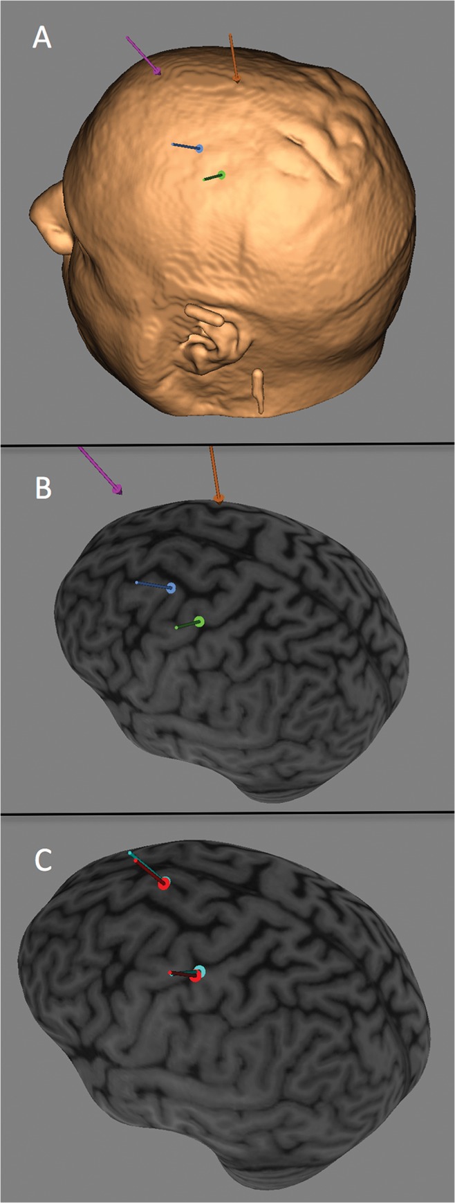 Fig 2