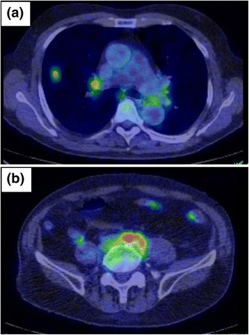 Fig. 2