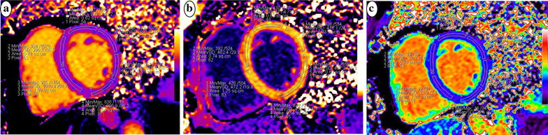 Fig. 1