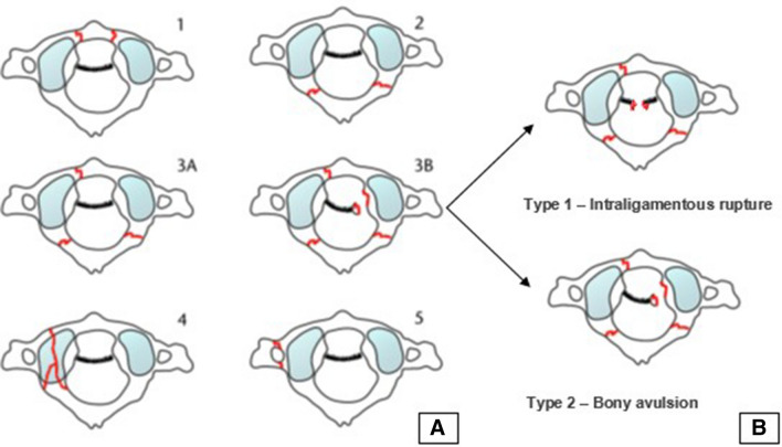 Fig. 1