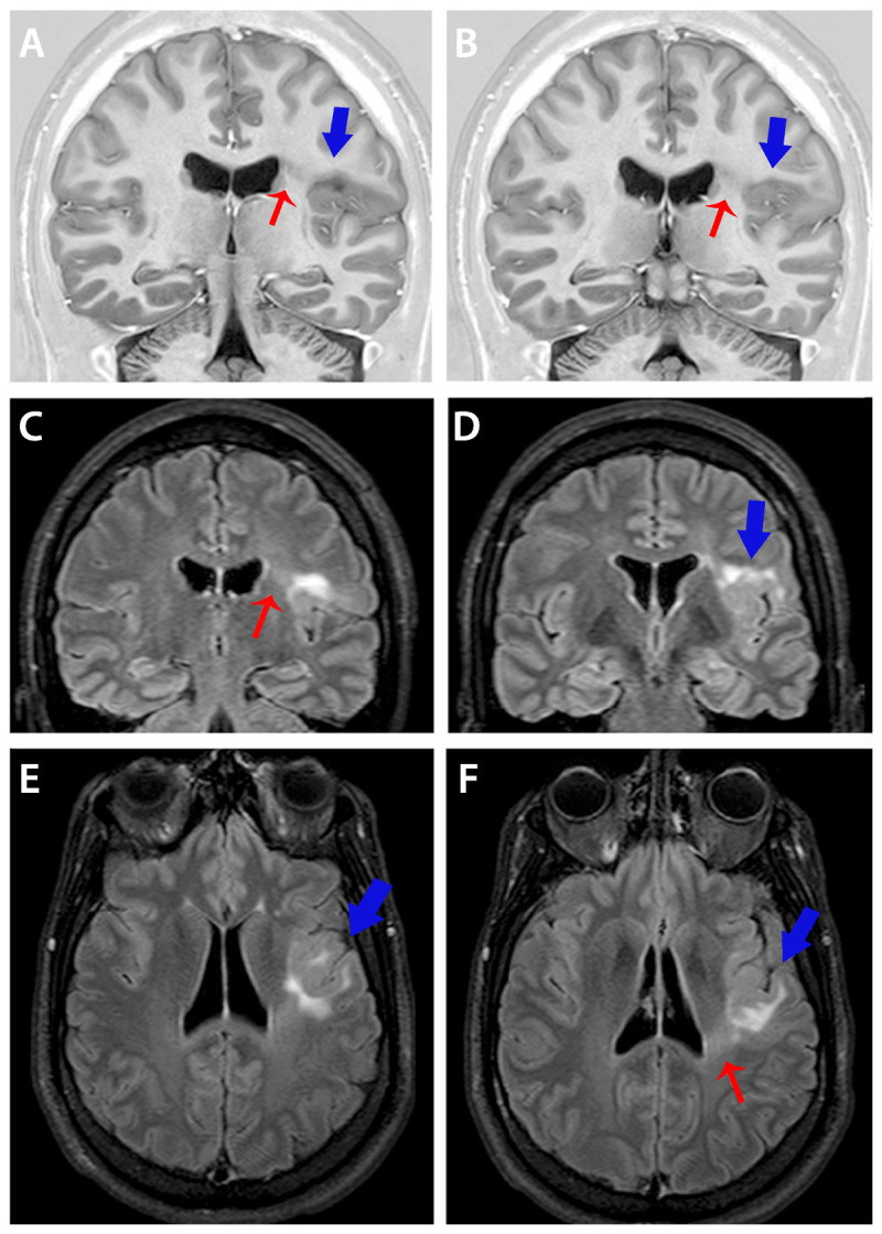 Figure 3-5.