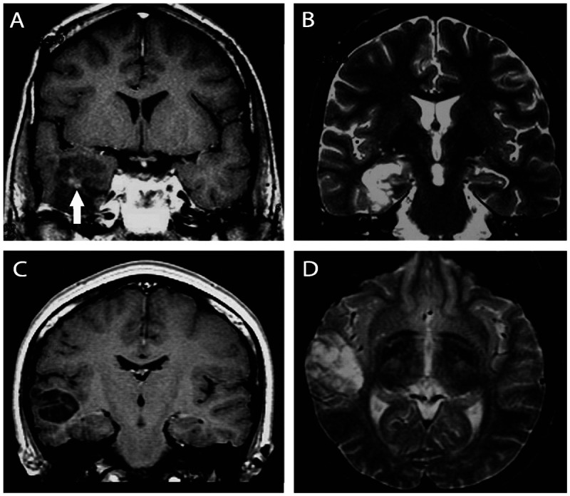 Figure 3-12.