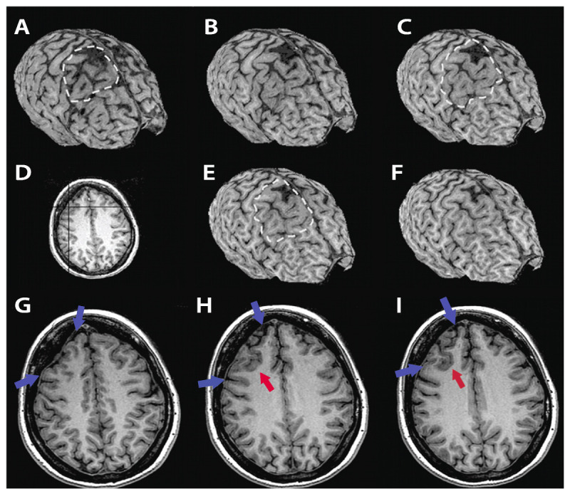 Figure 3-4.