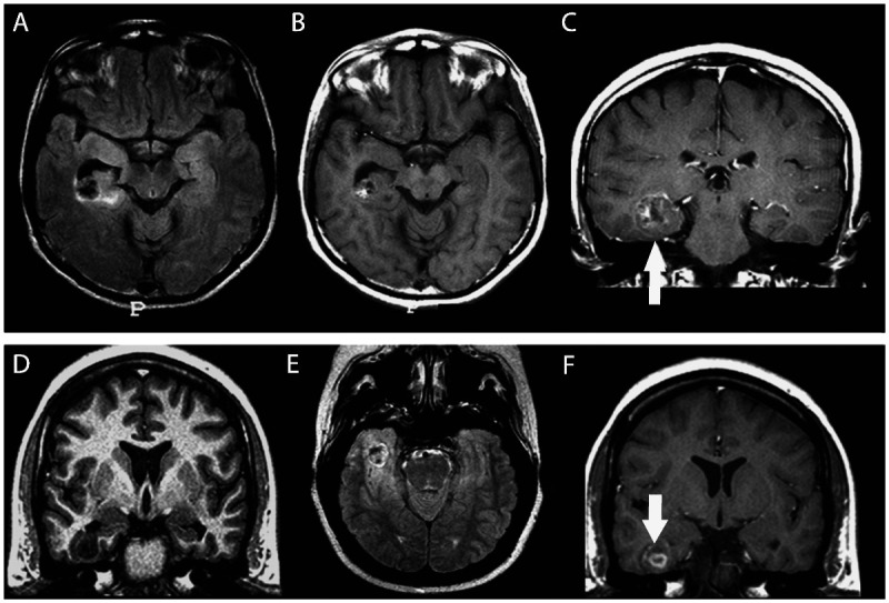 Figure 3-11.