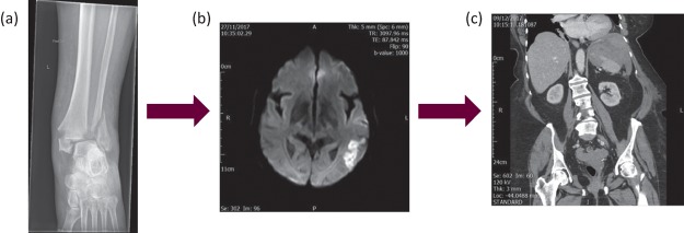 Fig 1.