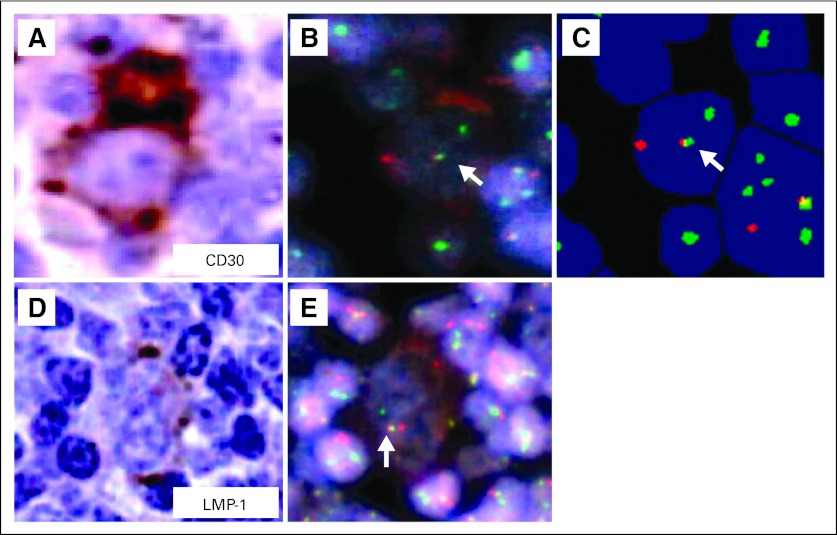 Fig 2.