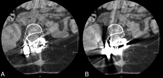 Fig 1.