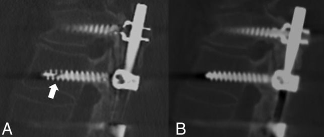 Fig 3.