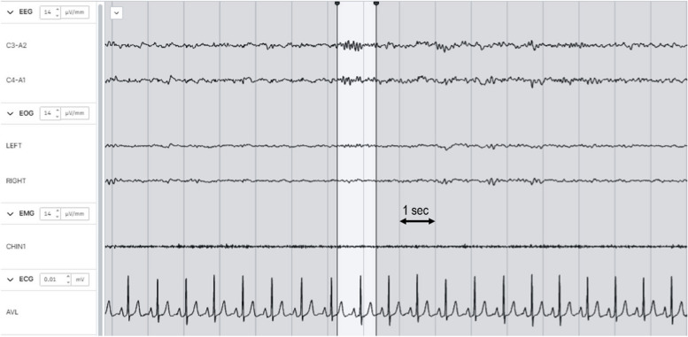 Fig. 1
