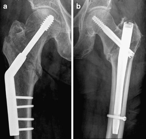 Fig. 1