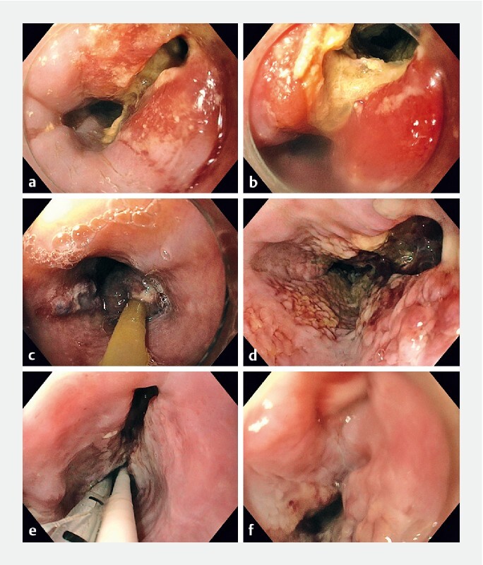 Fig. 1 