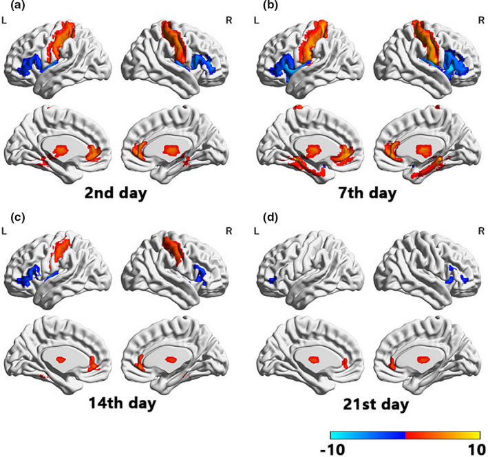 FIGURE 2